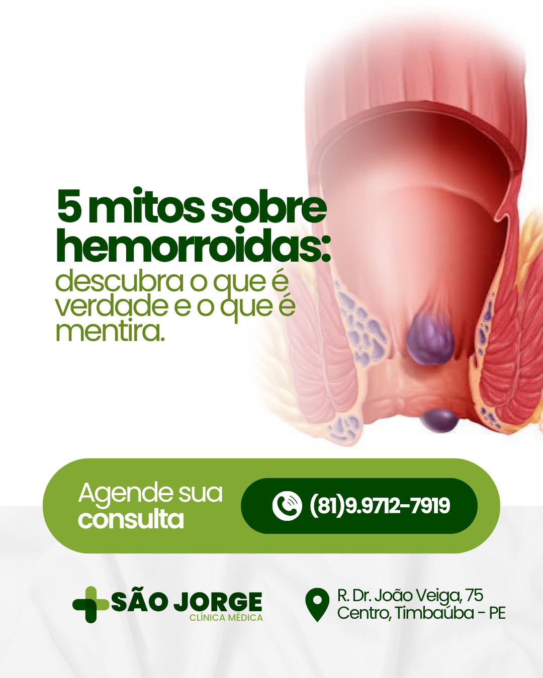 Campanha da clínica: Cinco mitos sobre hemorroidas